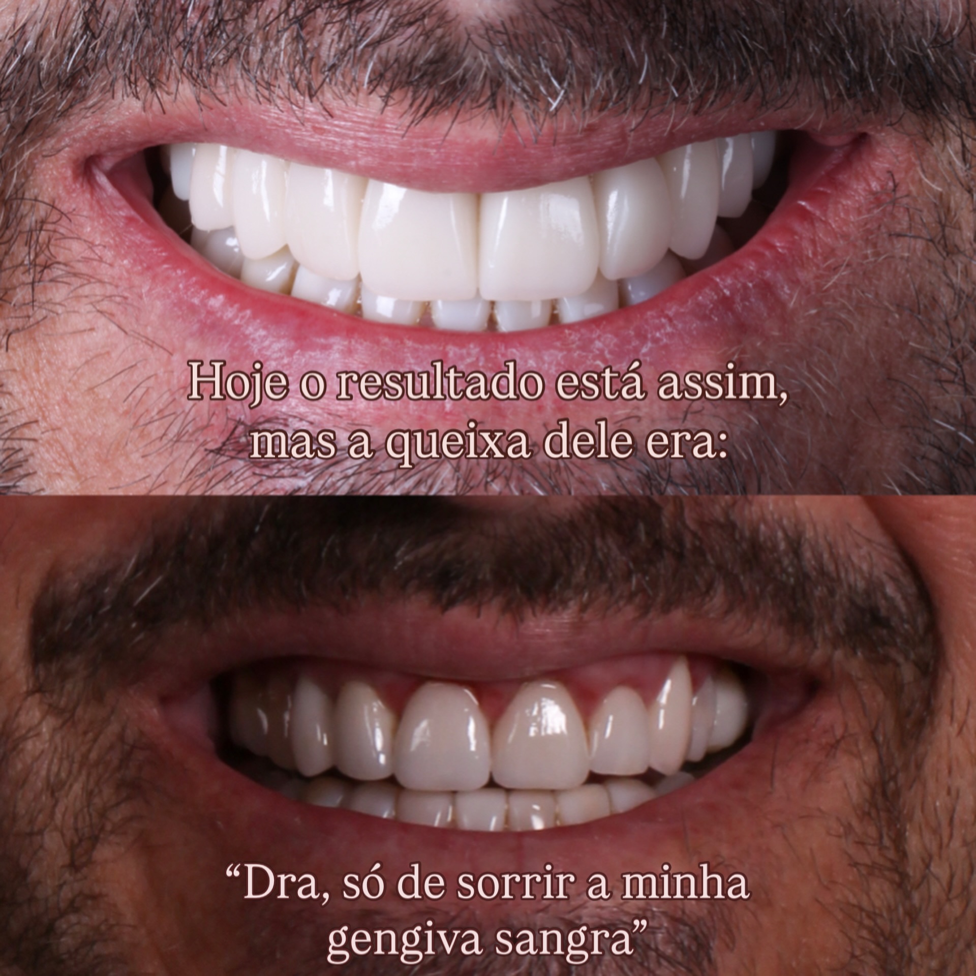 Estética e saúde gengival